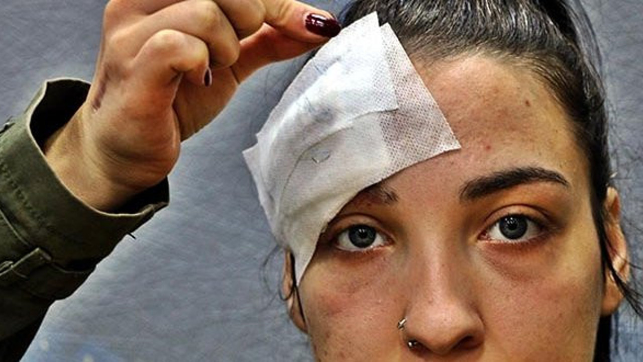 Dikiş atan doktor, iğneyi yarada unuttu