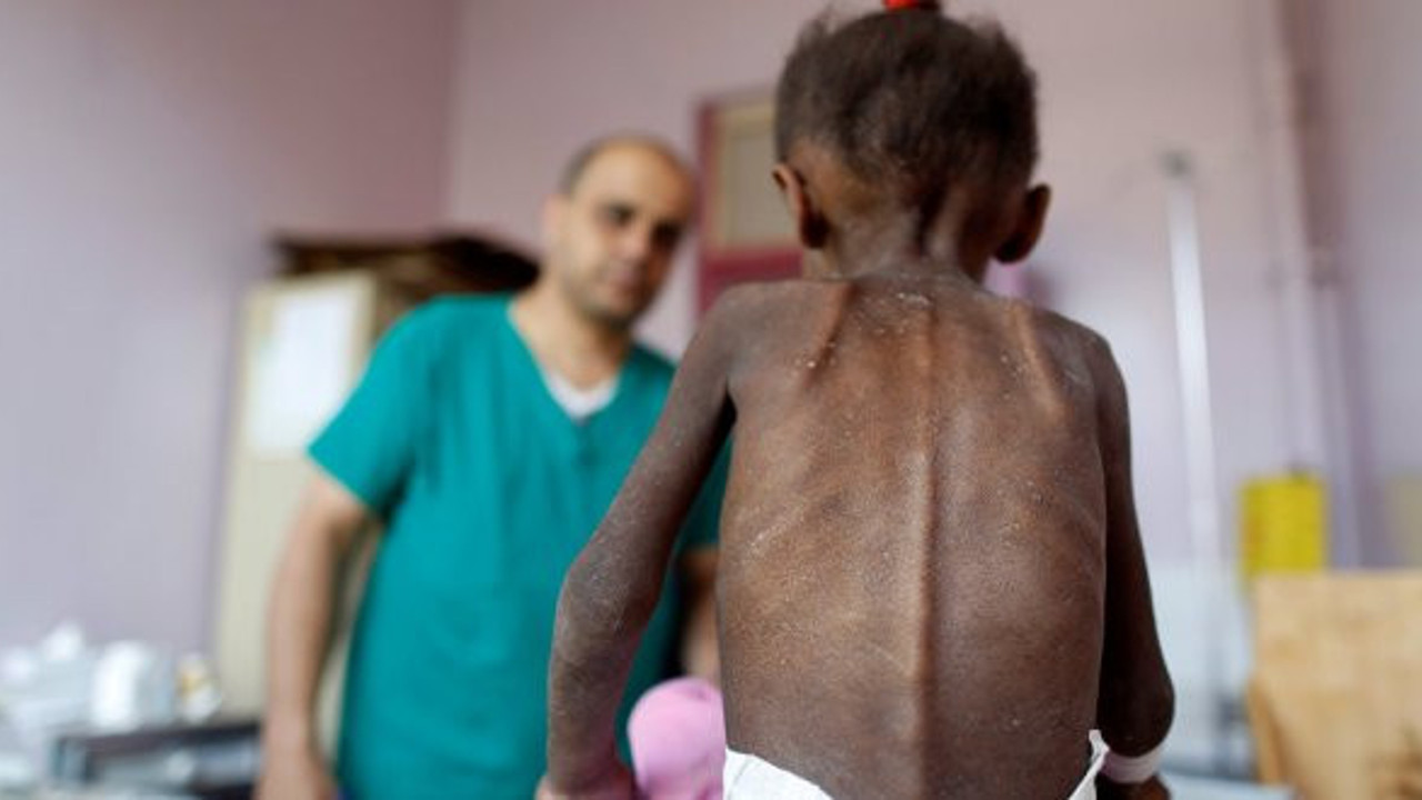 Yemen'de 85 bin çocuk açlıktan öldü!