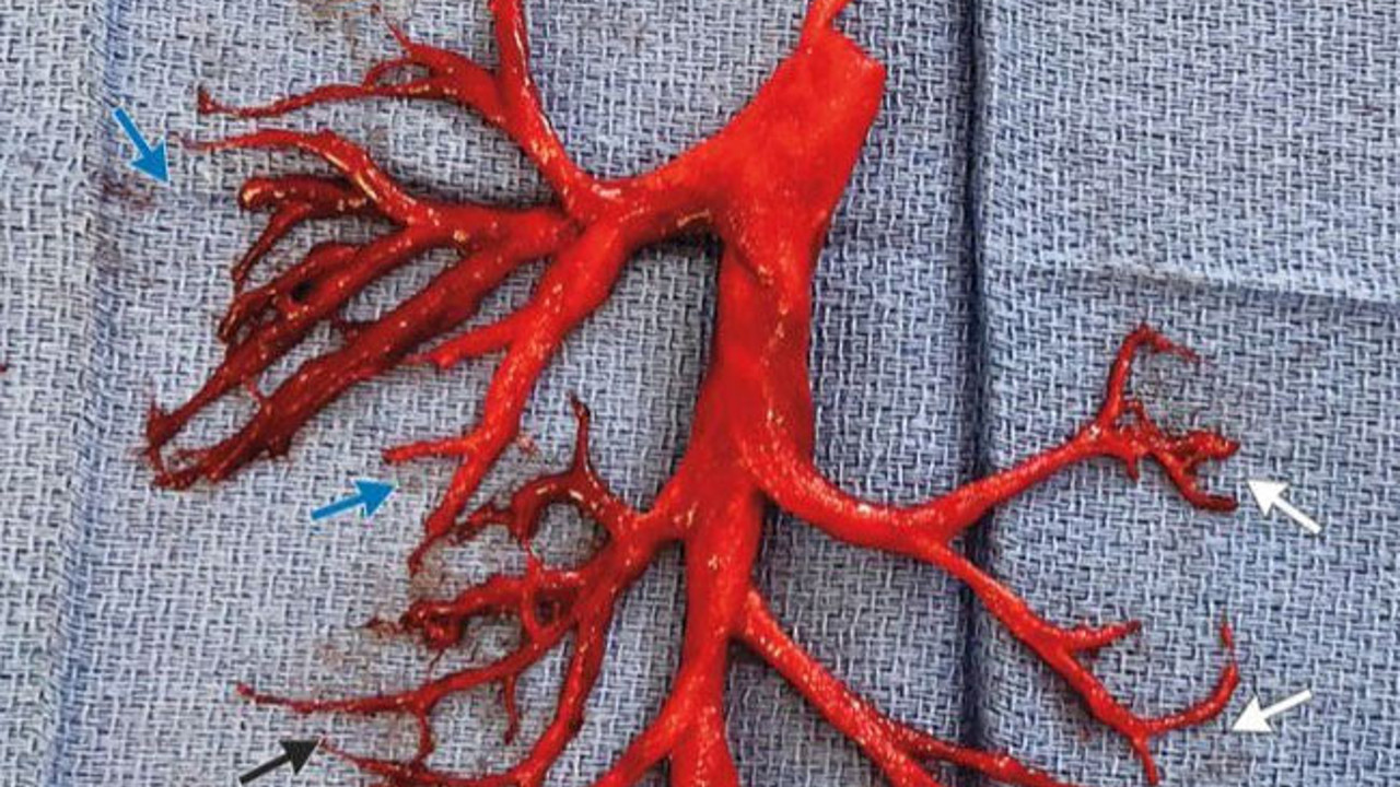 36 yaşındaki hasta tıp dünyasını şoka soktu!