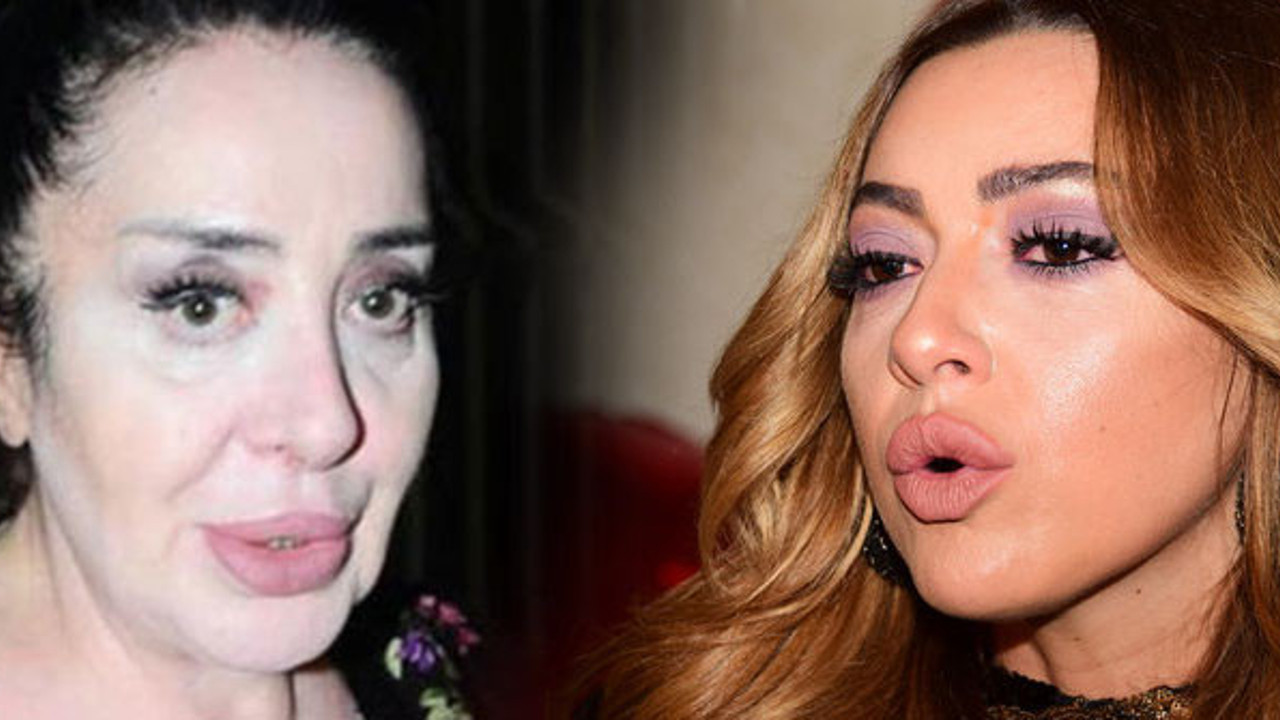 Nur Yerlitaş Hadise'den özür diledi