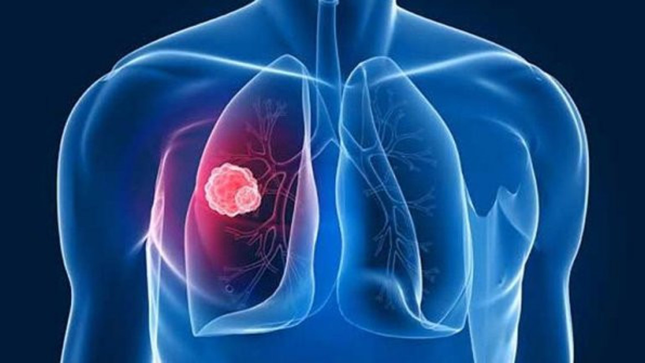 ABD’li Profesör: "Kansere karşı yeni silah eksozom"