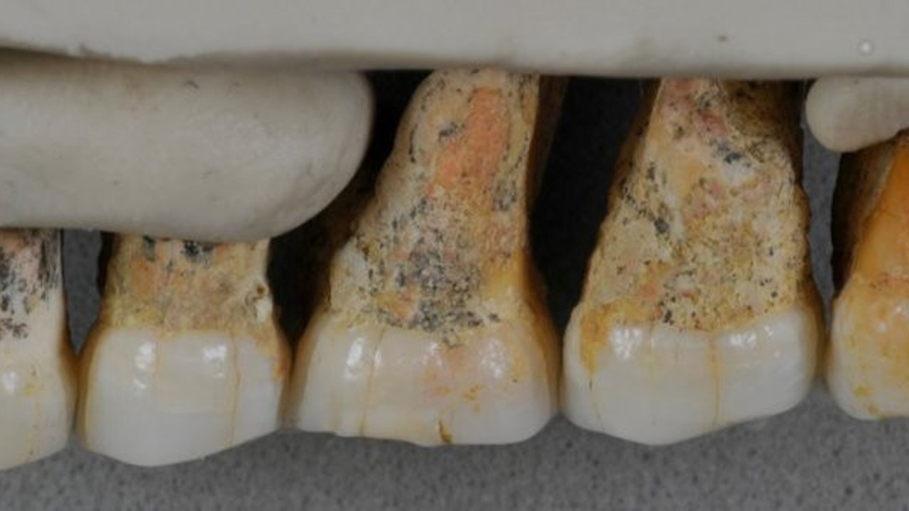 'Filipinler'de bulunan fosiller yeni bir insan türüne ait'