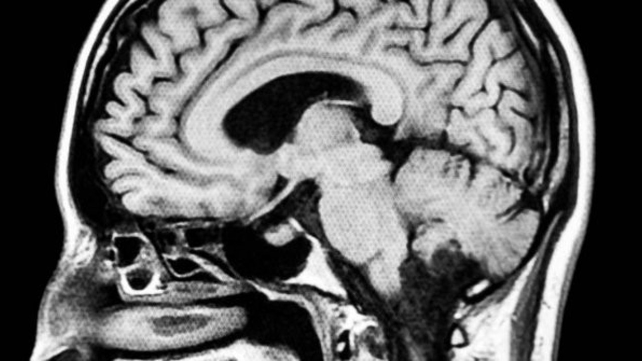 Bilim insanlarının hedefi beyni "ayarlamak"