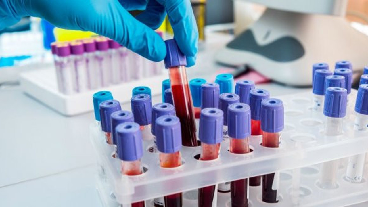 A kan grubu 0 grubuna dönüştürülebilecek!