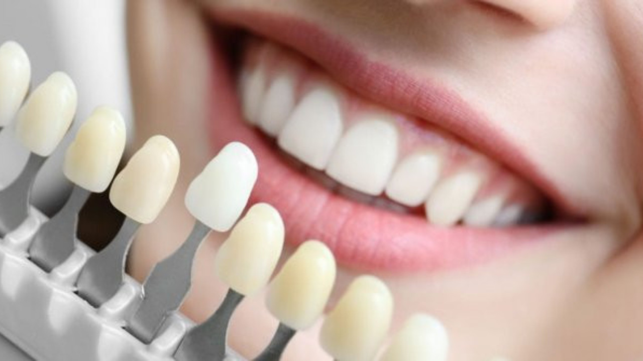 Dişlerdeki renk değişimi hangi sebeplere bağlı?