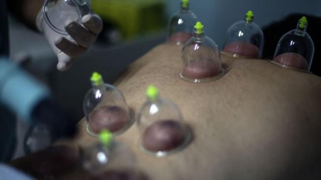 Yılda iki kez hacamat yaptırın