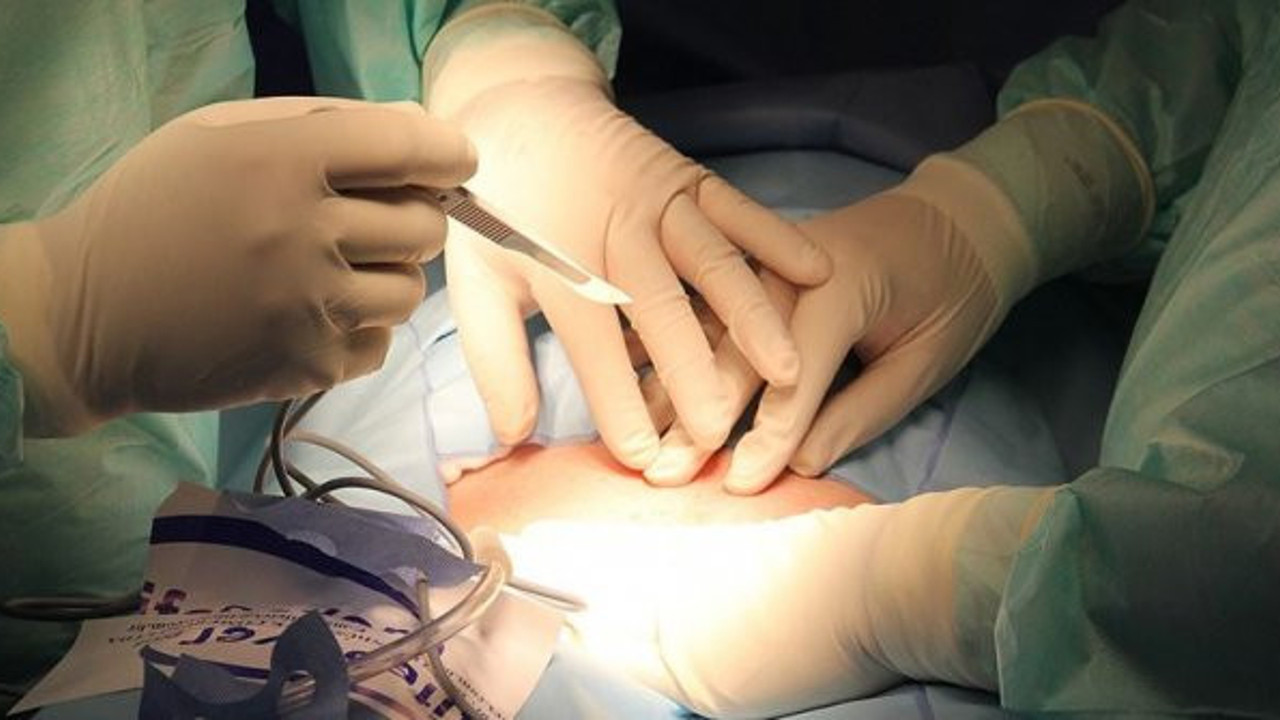 "Türkiye, organ bağışında dünyanın gerisinde"