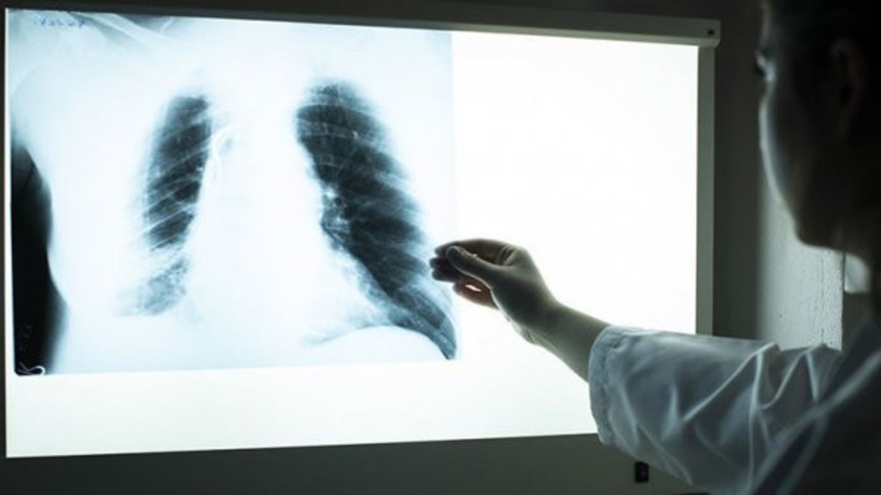 Aşırı kilolularda astım riski