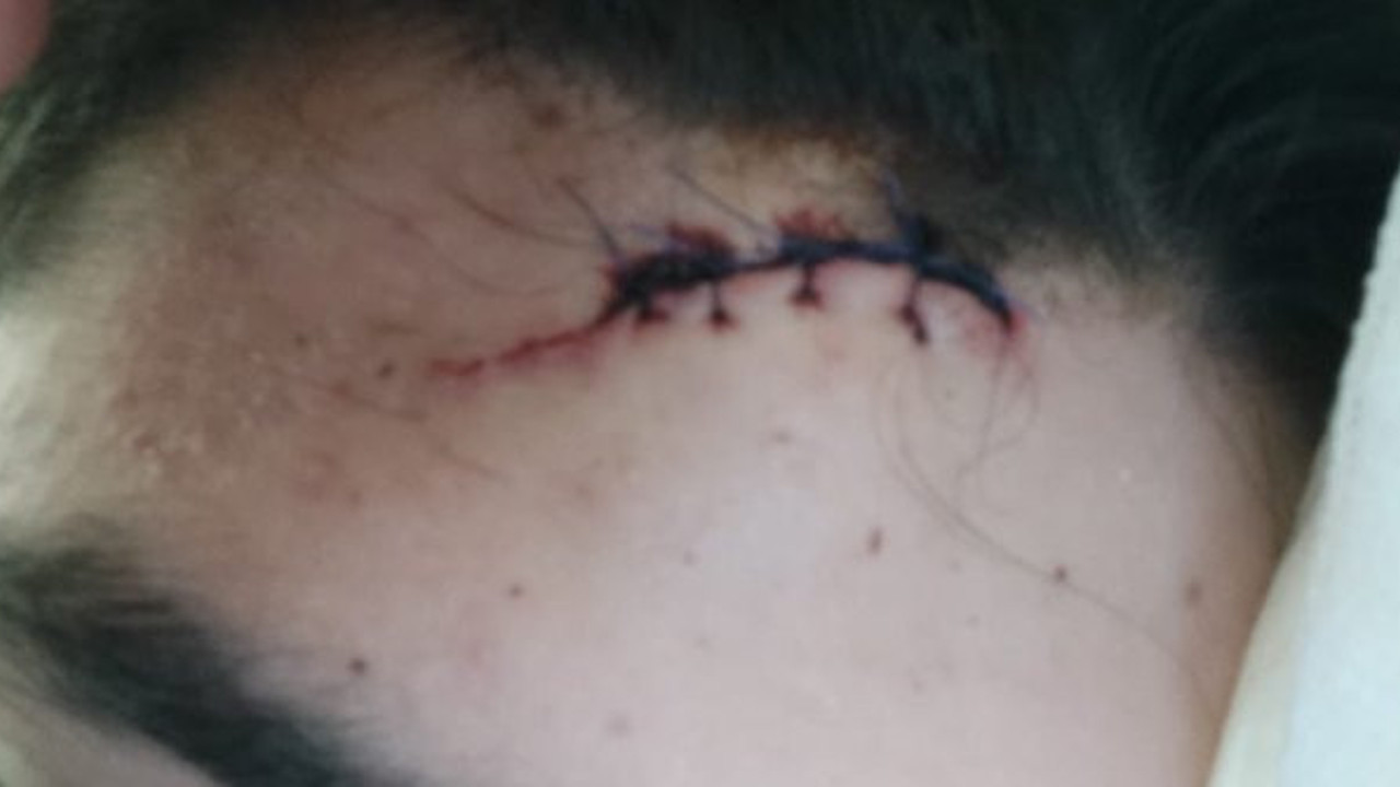 ODTÜ'lü gençlere satırlı saldırı