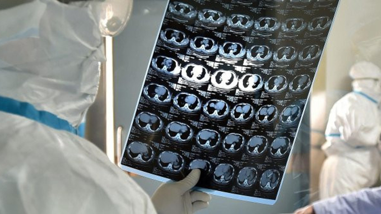 Coronavirüs gizlenmek istendi: Doktor susturuldu!