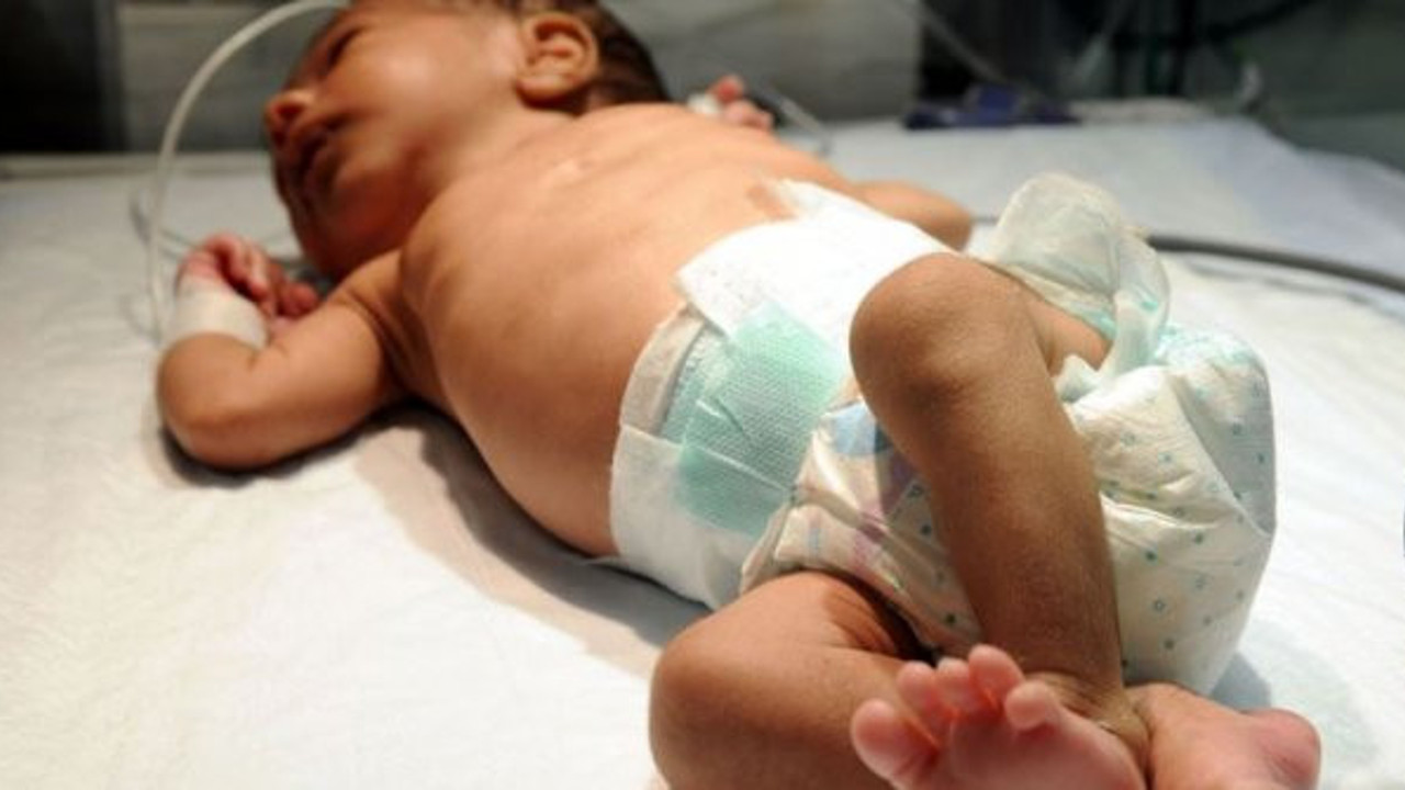 "Türkiye'de her yıl 15 bin bebek kalp hastalığıyla doğuyor"