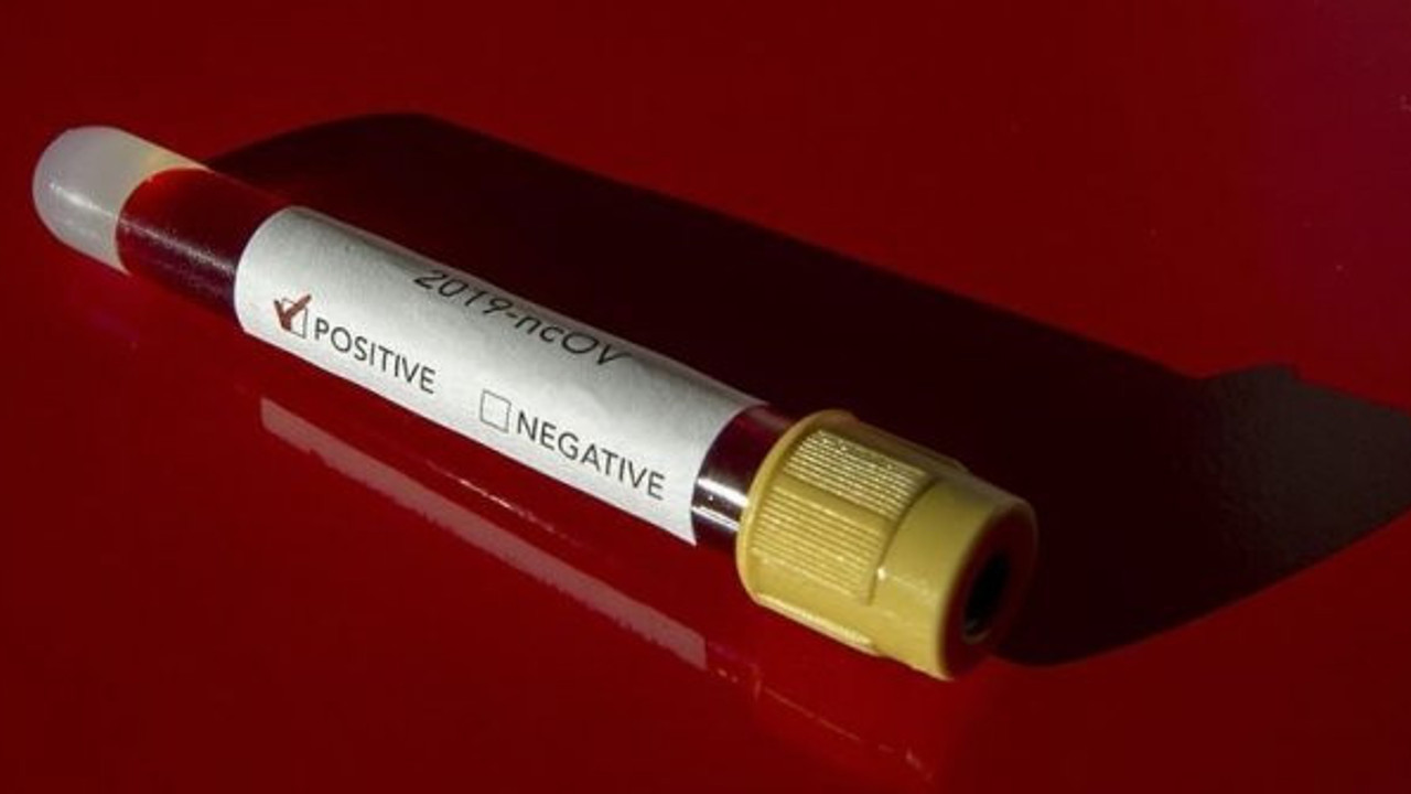 Corona virüs üç ülkede daha görüldü