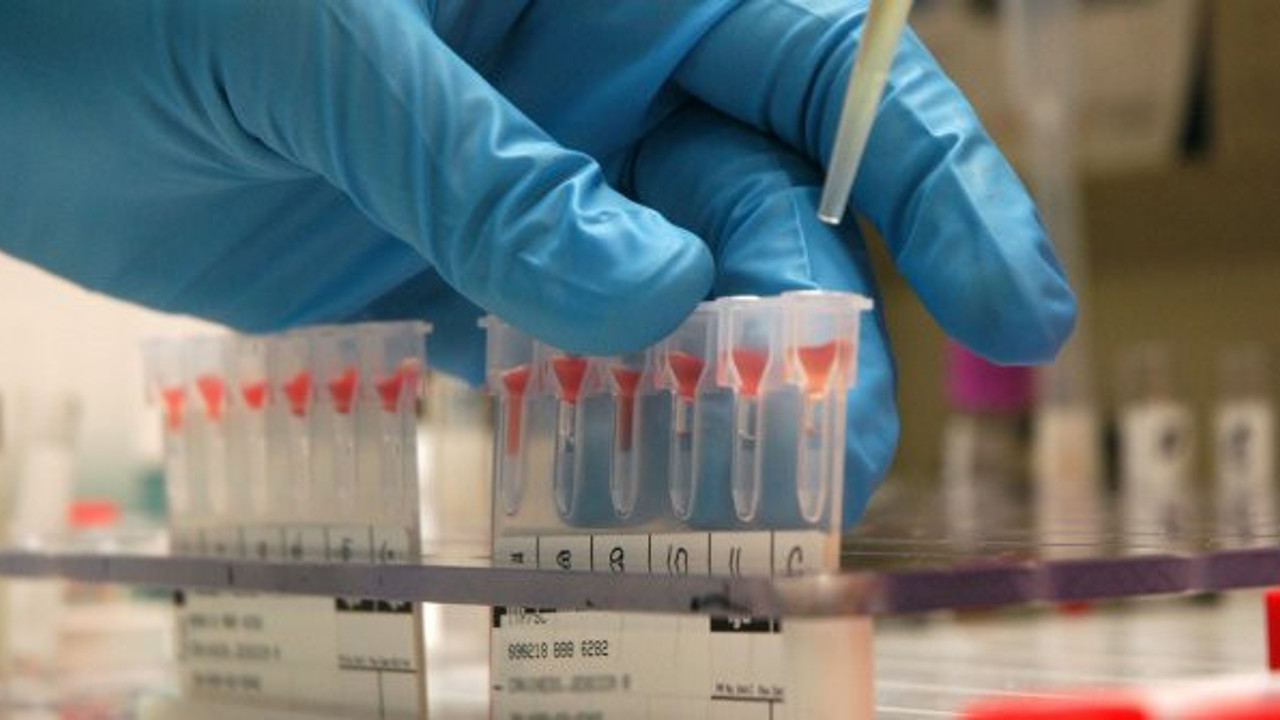 Korona virüs, o kan grubuna daha çok bulaşıyor