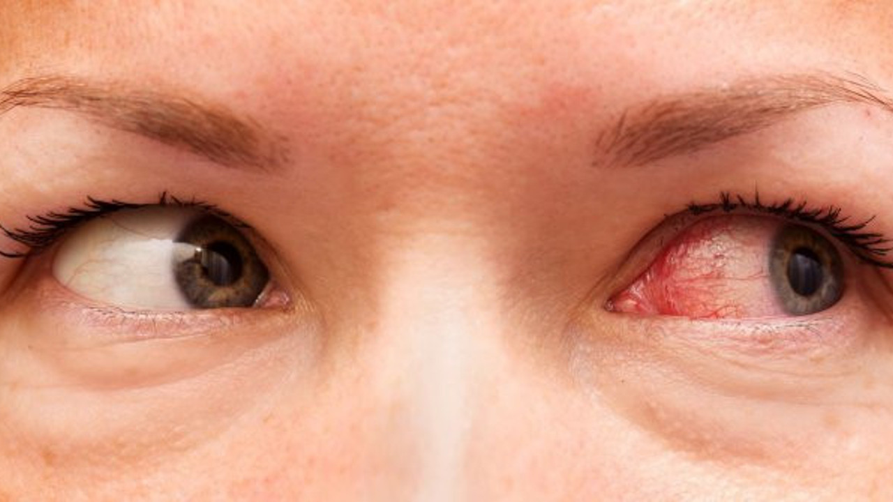 Aman dikkat: Bu belirtiler varsa...