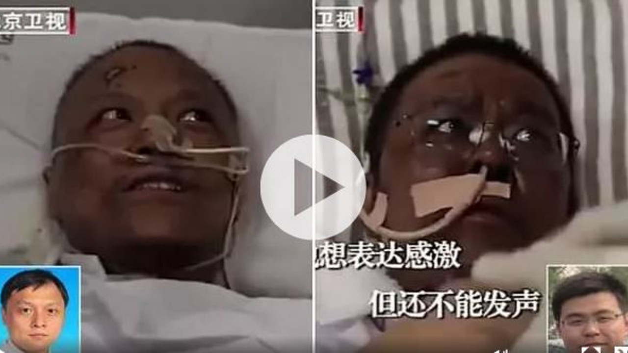 Koronavirüsü yenen doktorların ten rengi değişti