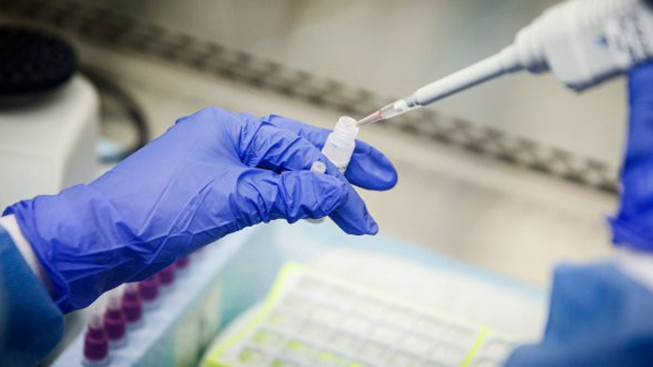 Oxford Üniversitesi korona aşısını insanlar üzerinde deneyecek