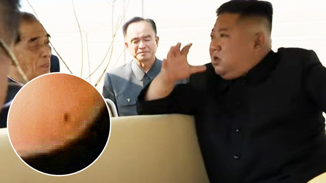 Kalp ameliyatı olduğu iddia edilmişti, Kim Yong- Un’un o fotoğrafı ortaya çıktı