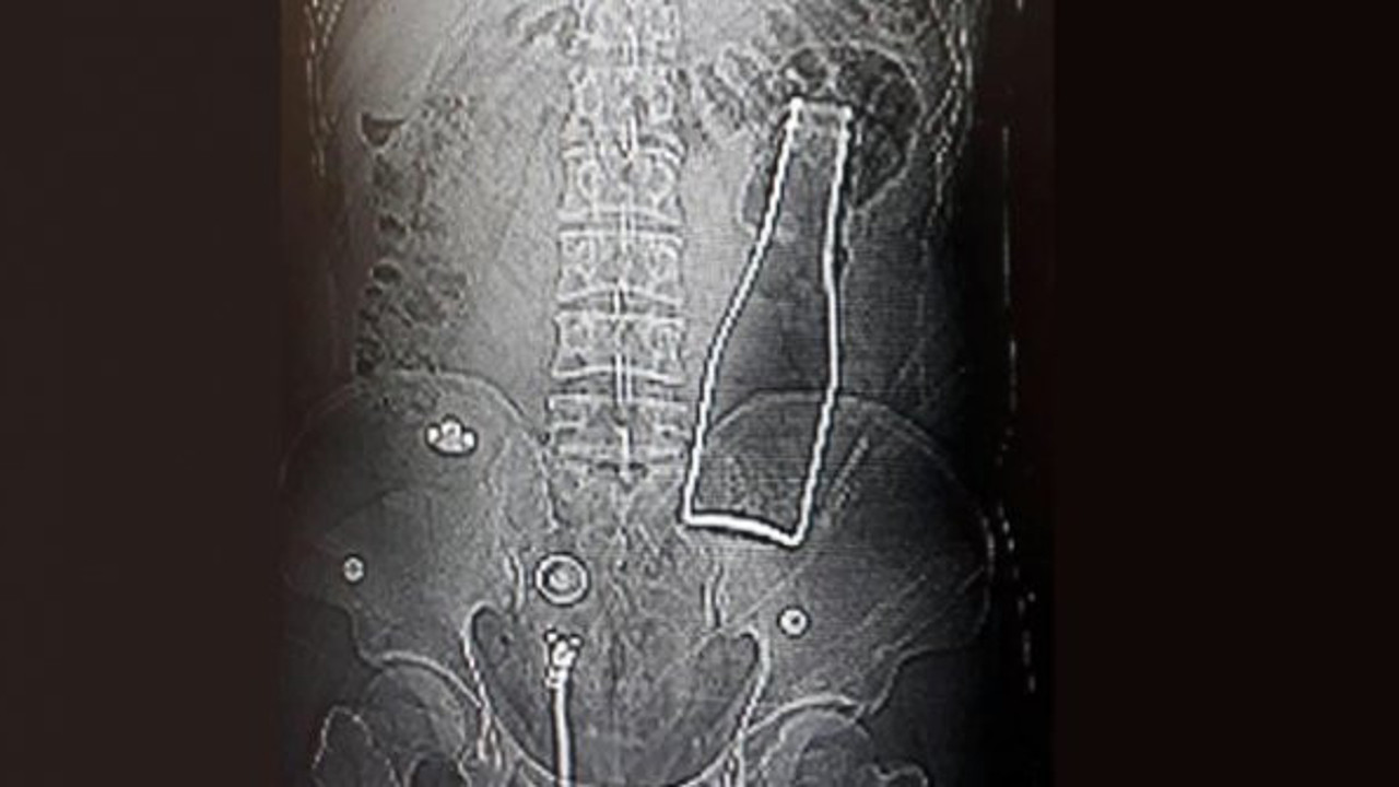 Karın ağrısı şikayetiyle gitti: Polis soruşturma başlattı