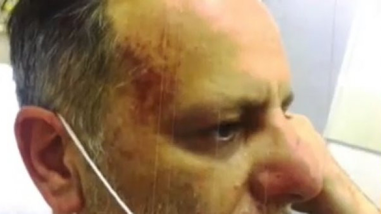 Biri büyük yalan söylüyor Ozan Güven mi Deniz Bulutsuz mu? Bir kadın bu hale kendi kendine gelir mi?