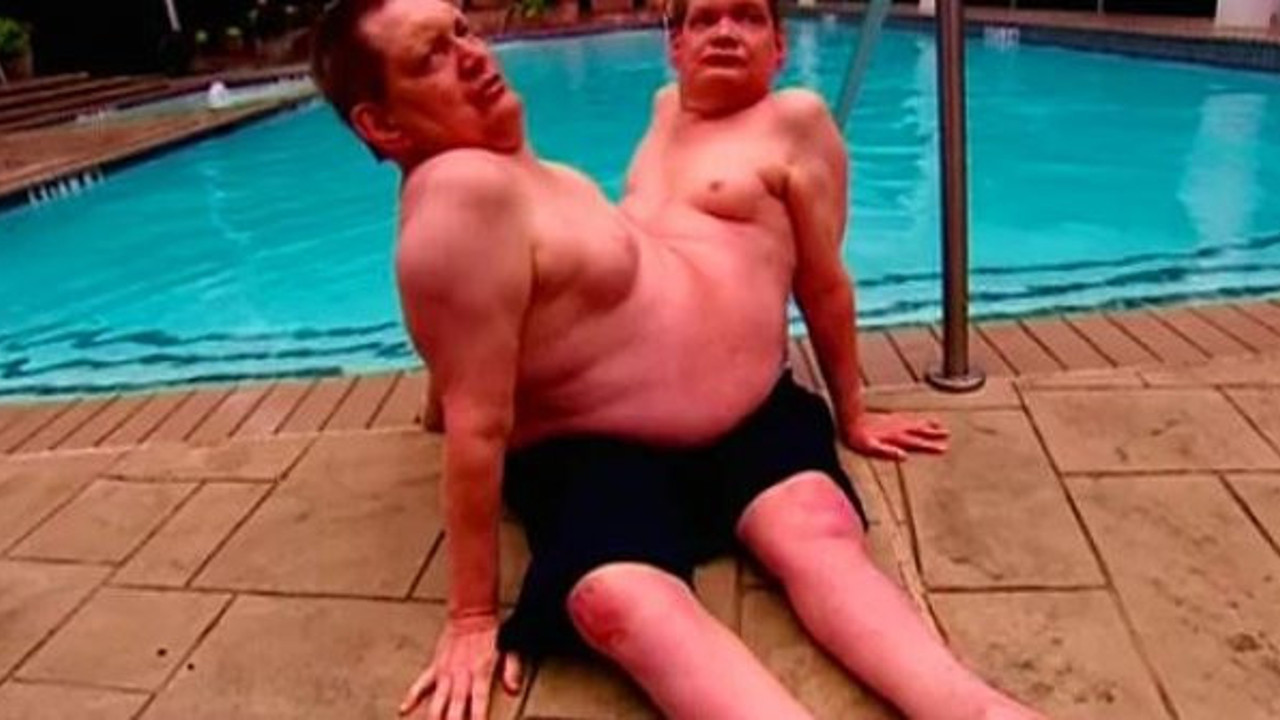 Bunca sene nasıl dayandınız, Guinness rekortmeni ikizler hayata veda etti