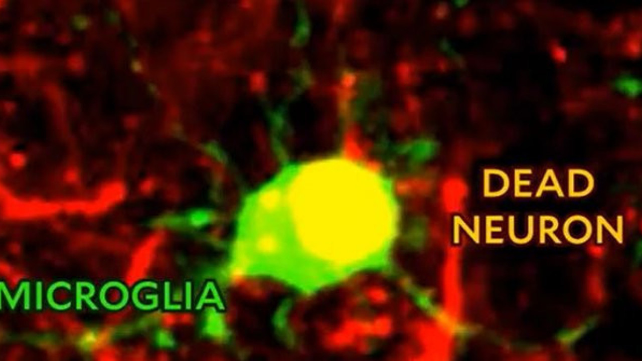 Bilim insanları ilk kez görüntüledi: Beyin kendini nasıl yeniliyor?