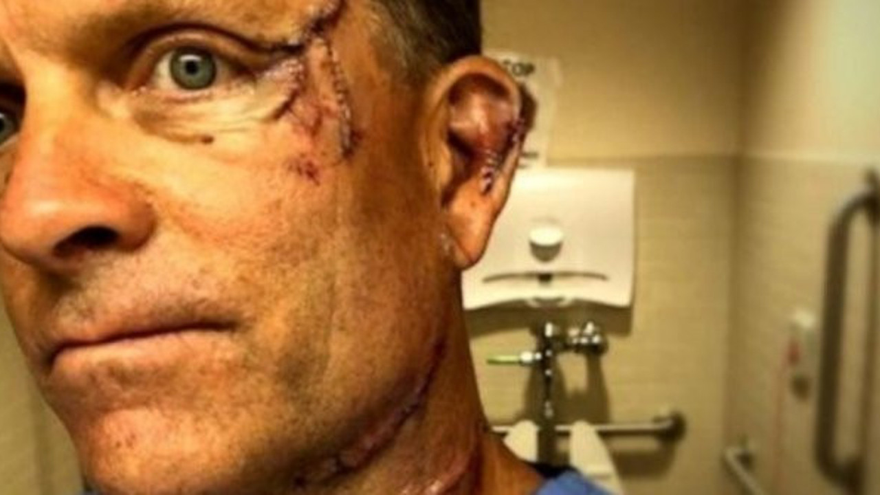 'Mutfakta biri mi var' dedi, bu hale geldi