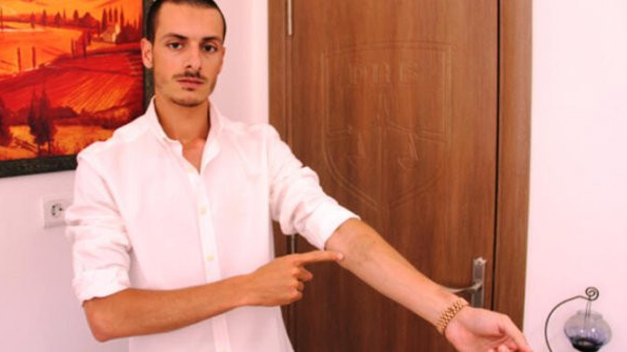 Yaptırdığı dövmeler hayallerini yıktı! Cildi çürümeye başladı