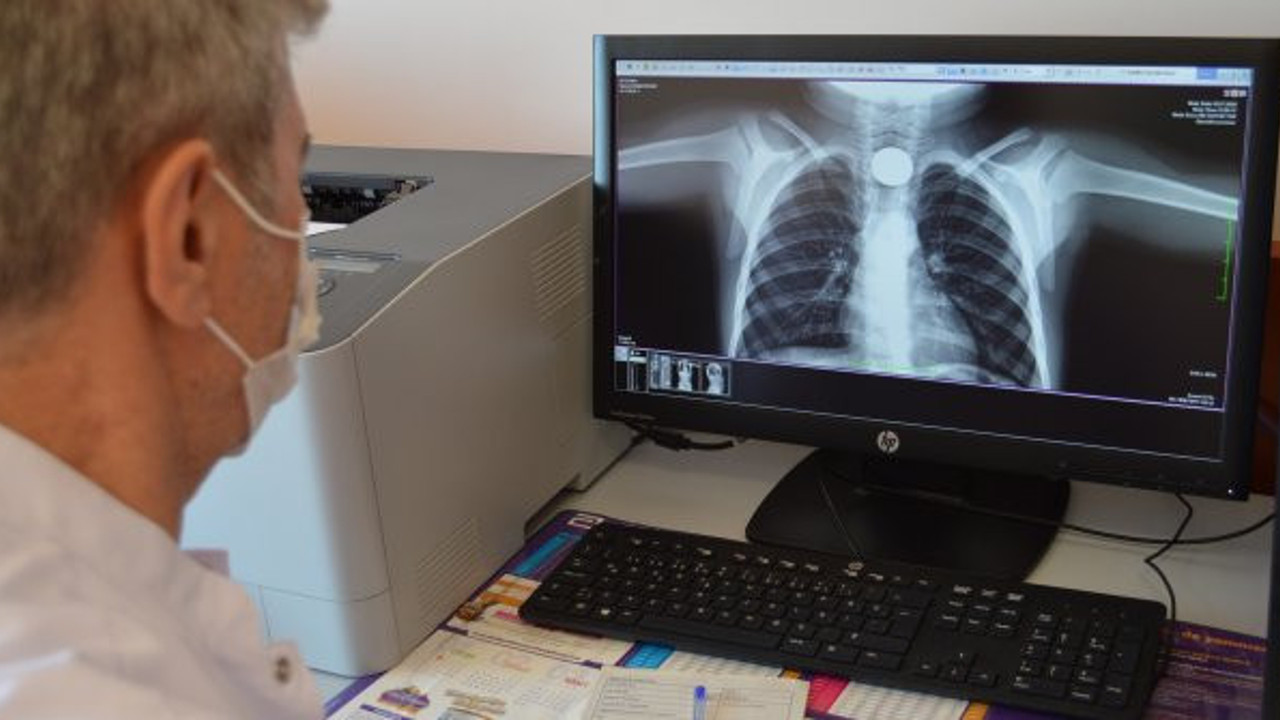 Elazığ'da, çocukların yuttuğu cisimler hastanede sergilendi