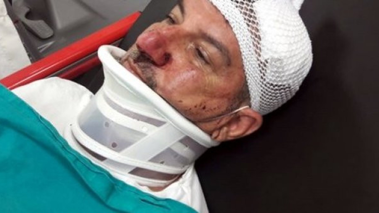 Adana'da dünür dehşeti! Kızının üstüne yapmadı diye bu hale getirdi...