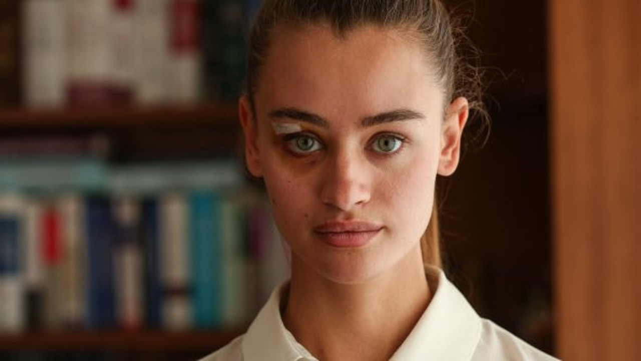 Dayak yiyen ünlü model sessizliğini bozdu! 2 ayrı kişi suratıma yumrukları indirdi