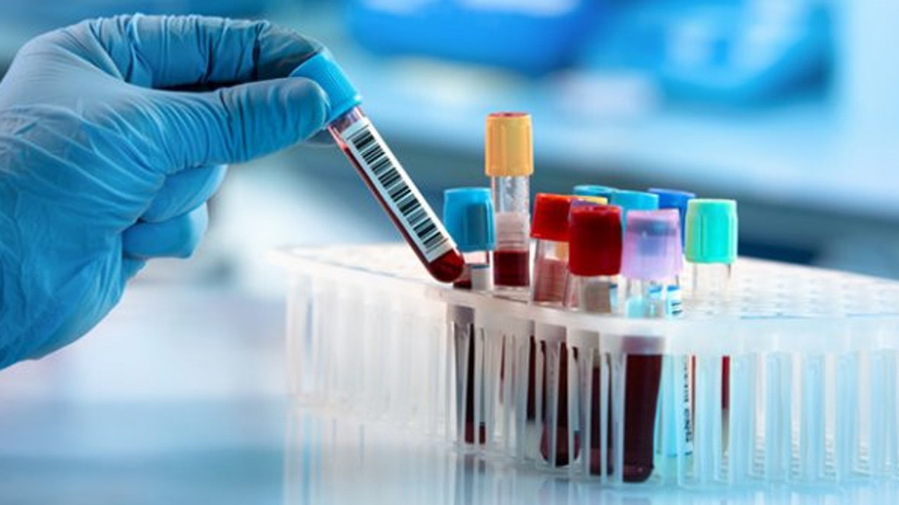 Sağlık Bakanlığı duyurdu, sayı 155 oldu