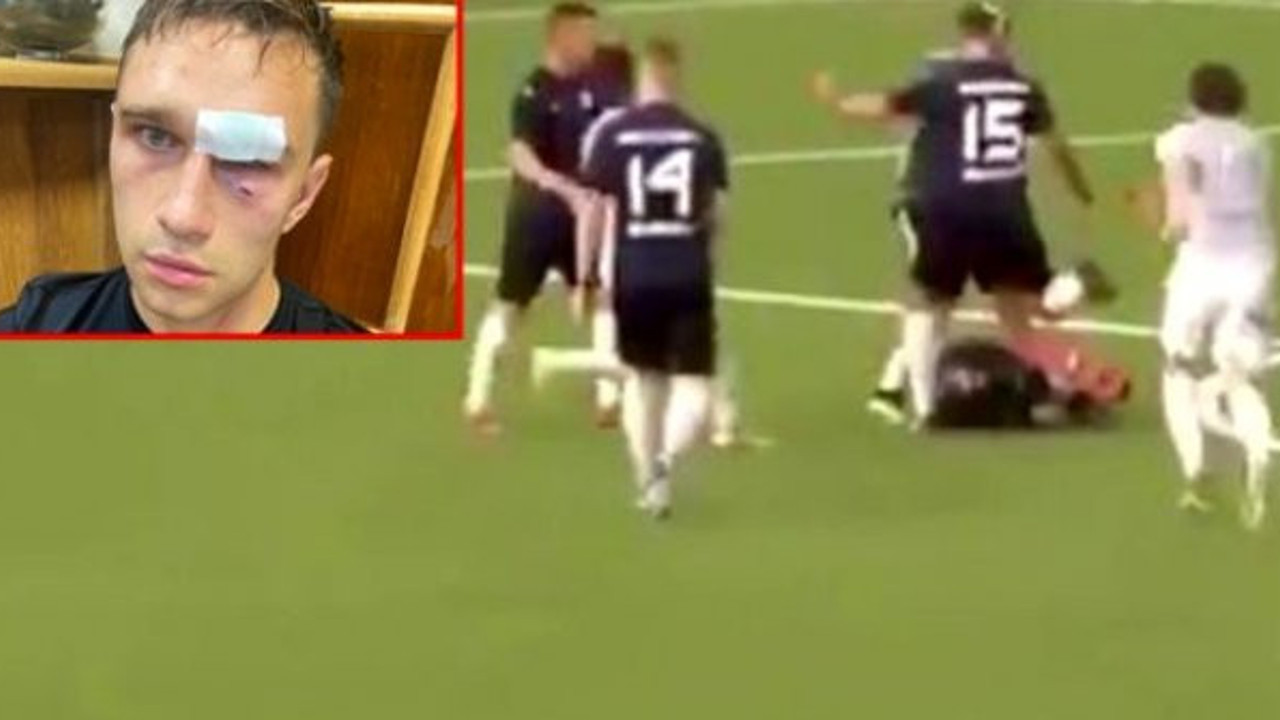 Rusya'da skandal olay! "Kart gösterirsen seni döverim" dediği hakemi hastanelik etti