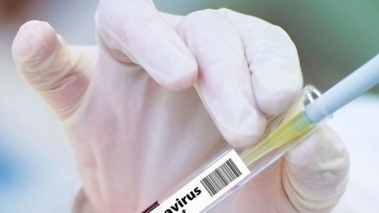 Rusya aşıyı bulduğunu açıklamıştı Dünya Sağlık Örgütü’nden uyarı geldi