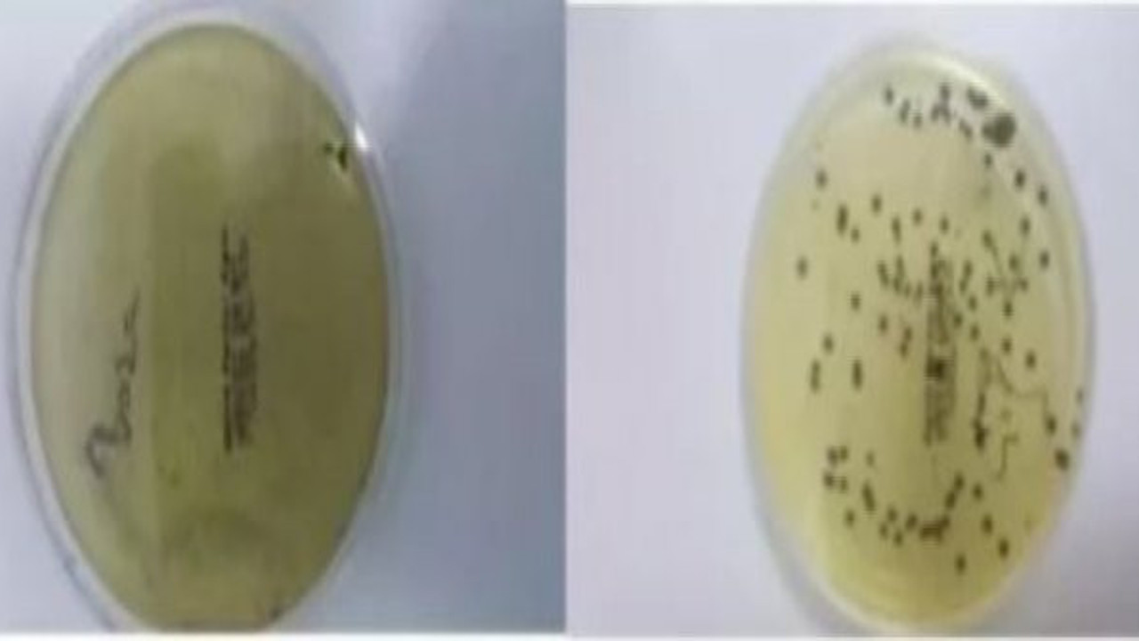 Simitçinin elinde, çiğ köftenin içinde: Sokaktan aldığınız bakteriler böyle görüntülendi!