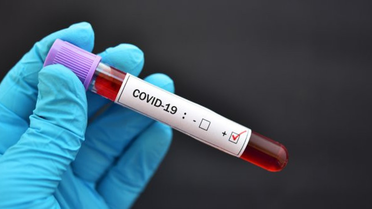 Hasta sayıları kırmızı alarm veriyordu: Pozitif vakalarla ilgili korkunç gerçek!