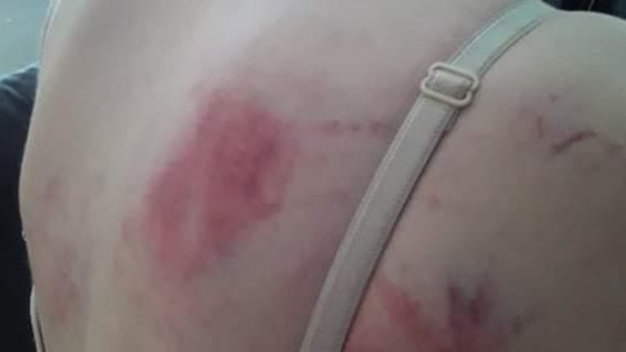 Vicdansız baba kızını İngiliz anahtarıyla bu hale getirdi! Tekirdağ bu vahşeti konuşuyor! Ellerin kırılsın