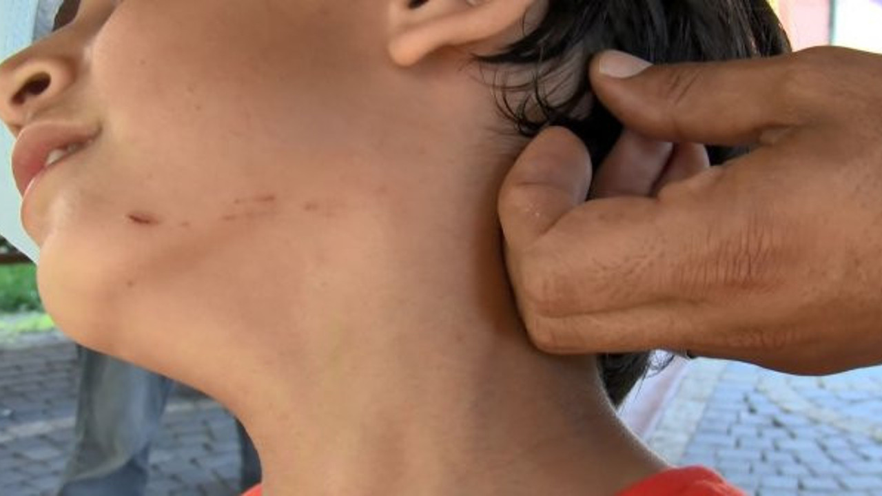 Torunu yaşındaki çocuğa pusu kurup suratını yırttı! İnsan demek için bin şahit lazım