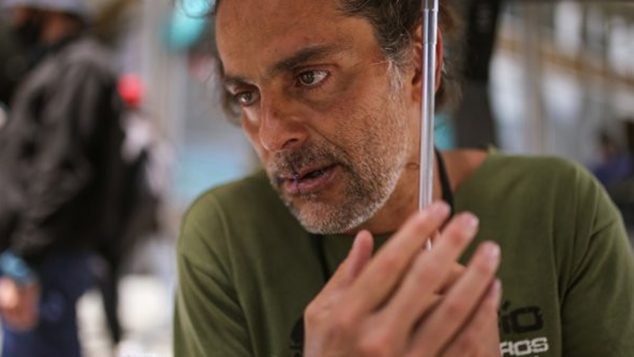 Dudaklarını dikti, sebebi ülkeyi karıştırdı