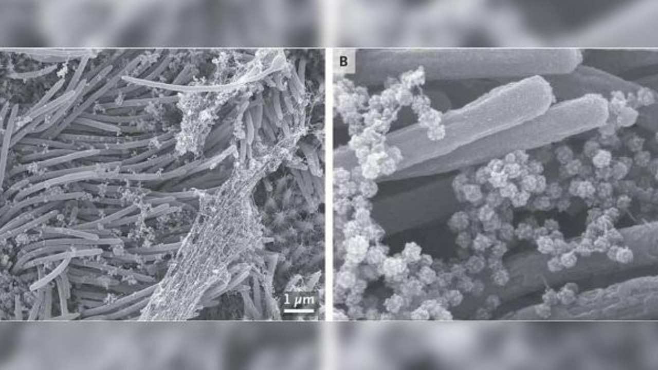 İşte işgal böyle başlıyor: Korona virüsün saldırı anı görüntülendi