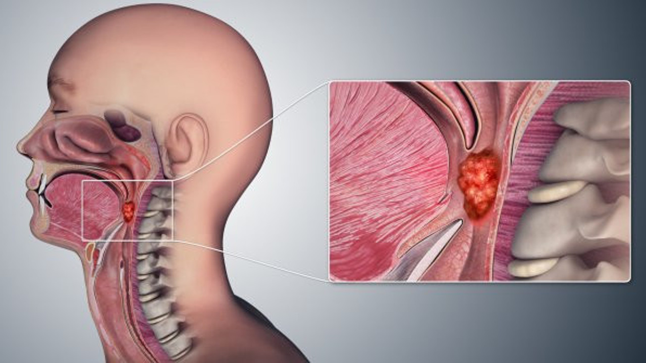 Bilim insanları 'müjde' diye duyurdu: Milyonlarca insanı perişan eden hastalık 8 yıl erkenden tespit edilecek