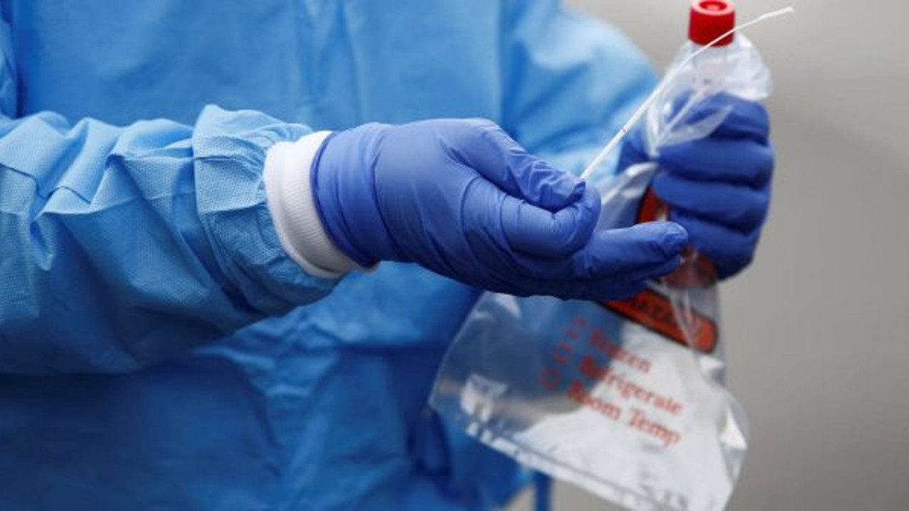 Antikor ilaçlarını seri üretime geçirecekler