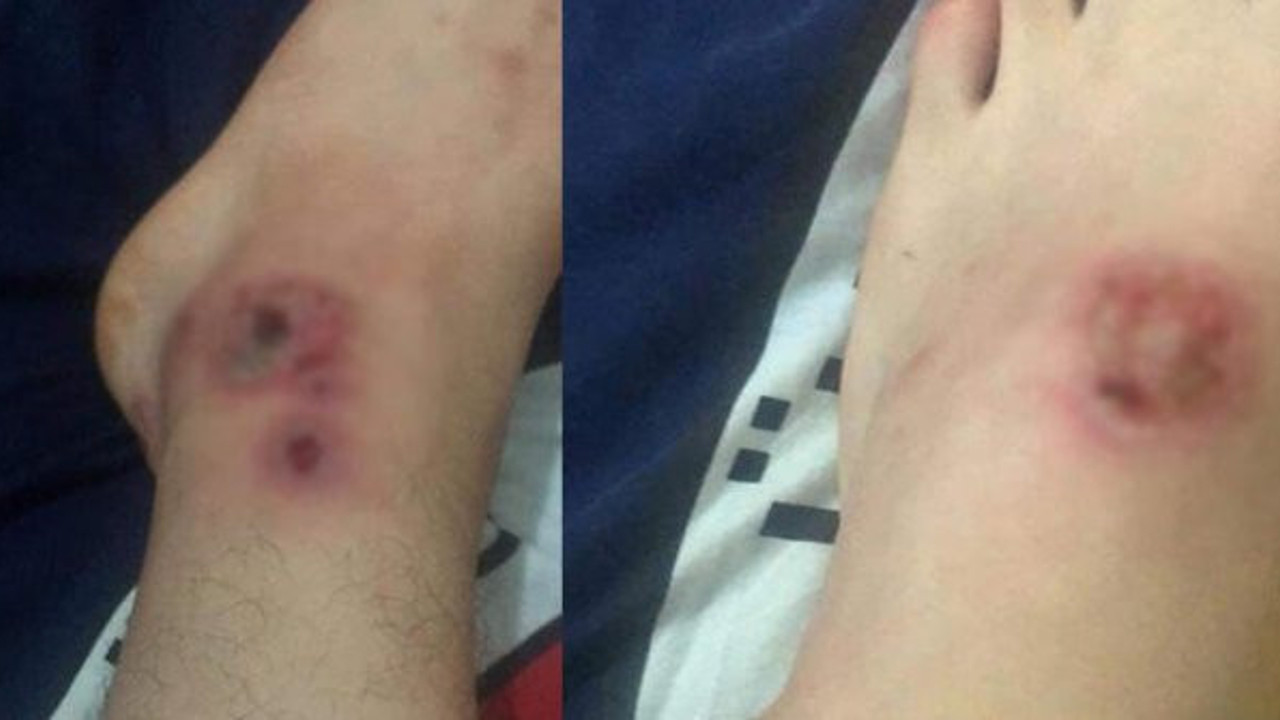 Asya Kaplanı paniği Türkiye'de büyüyor