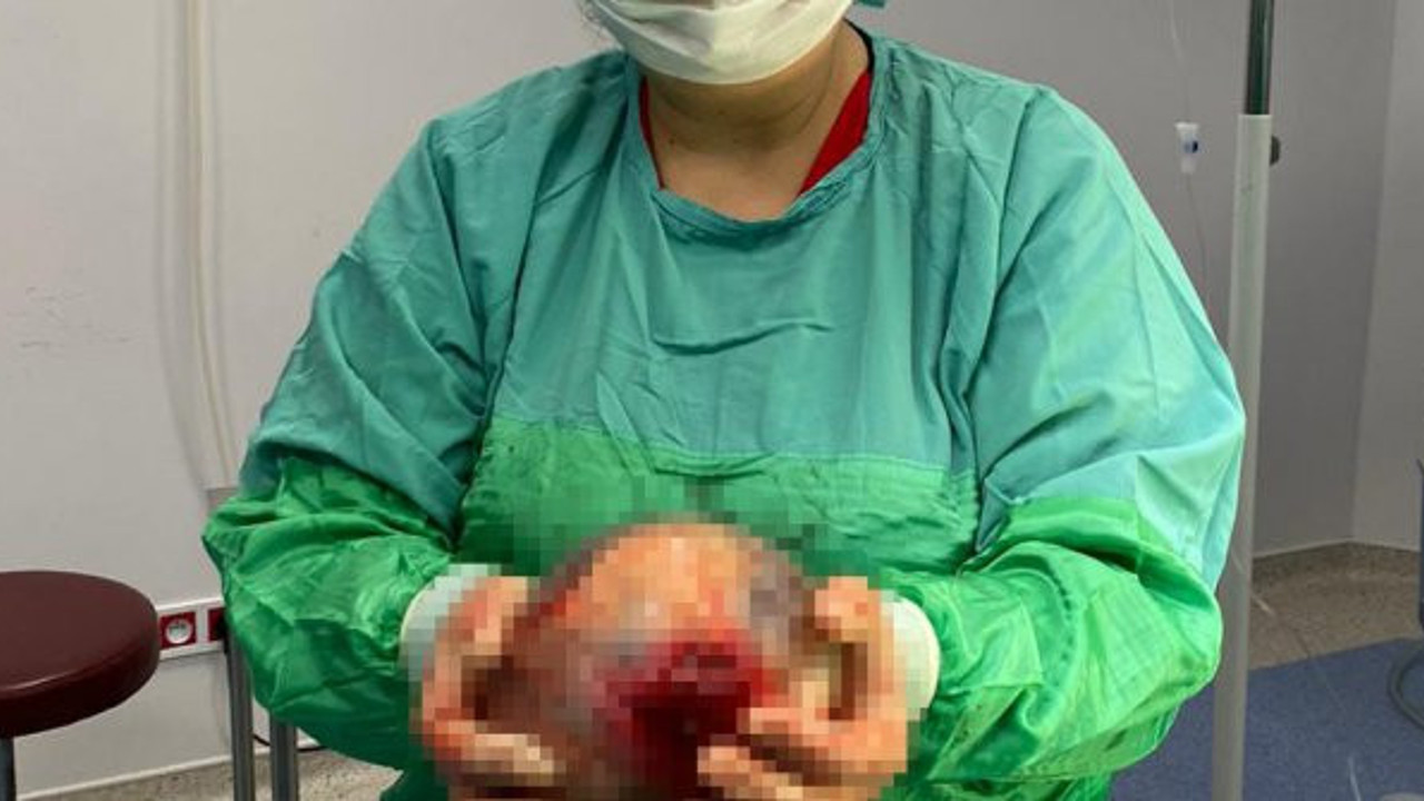 Kasık ağrısıyla hastaneye gitti! Doktorlar bile şaşkına döndü