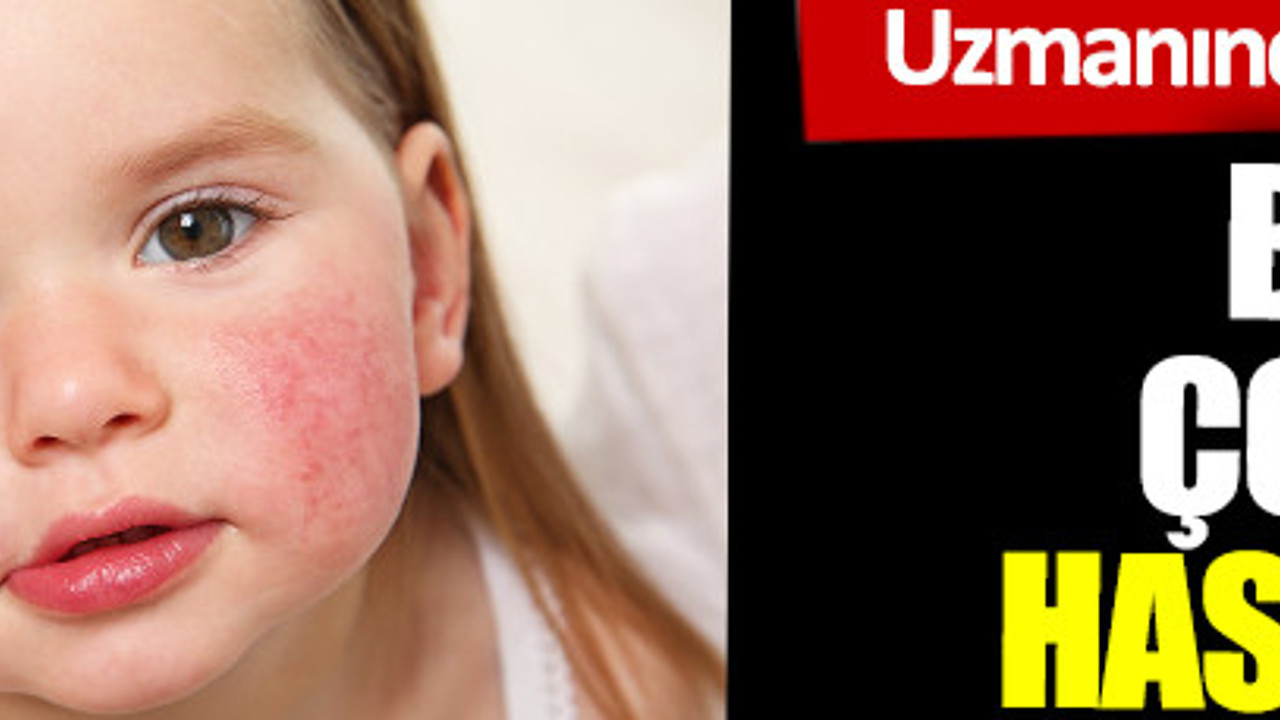 Uzmanından çok önemli uyarı. Bu besinler çocuğunuzu hasta edebilir