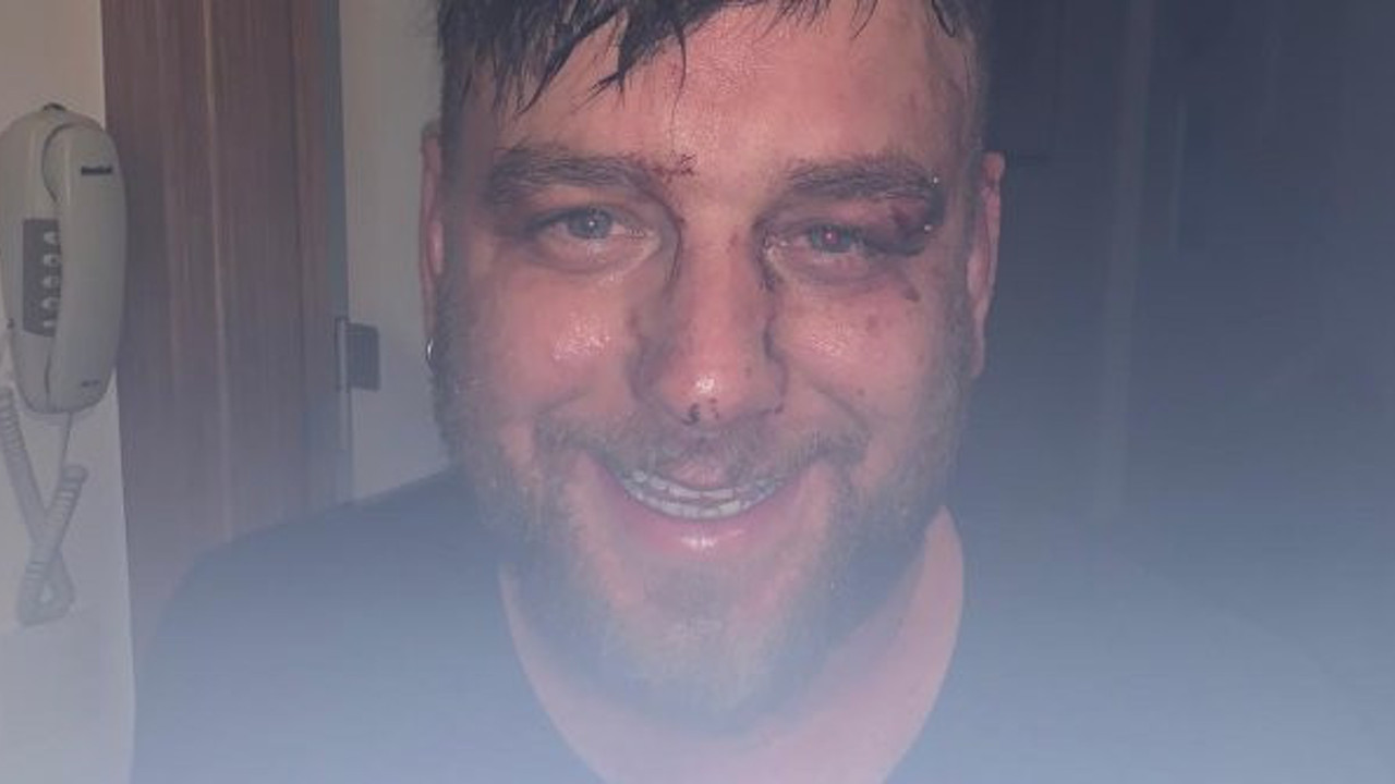 Biri neden dayak yediğini açıkladı bütün mahalle gerçeği bir bir itiraf etti. Böylesi ne görüldü ne duyuldu