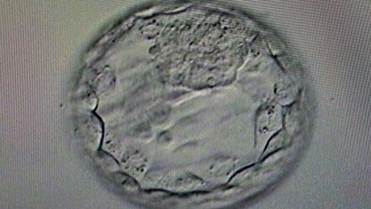 Gebelik yaşı tarihe karıştı. Doç. Dr. Davut Güven müjdeyi verdi