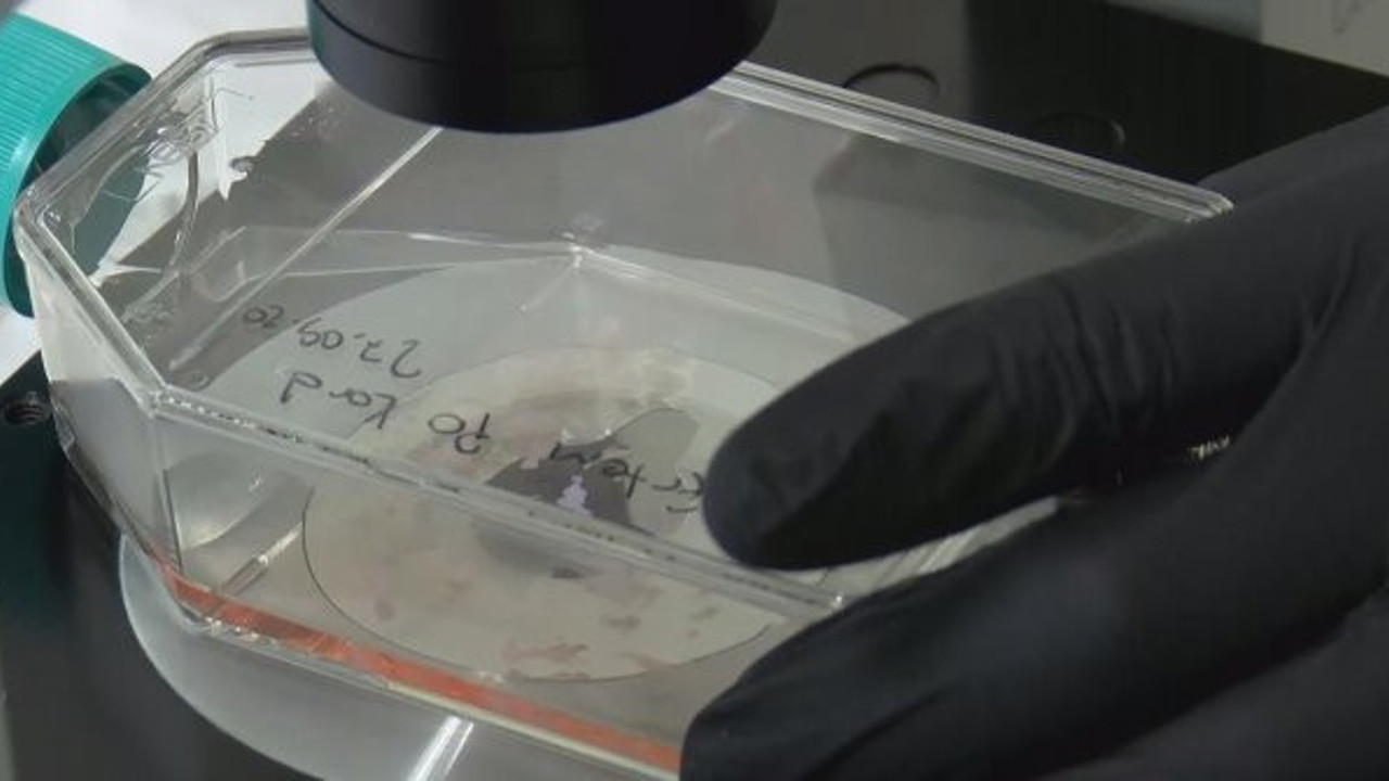 Türkiye'deki korona hastalarını yaşatmanın sırrı çöpte gizli. Ölüm oranı Türkiye'de yarı yarıya düşük diyen Prof. Dr. Gürsel Turgut açıkladı