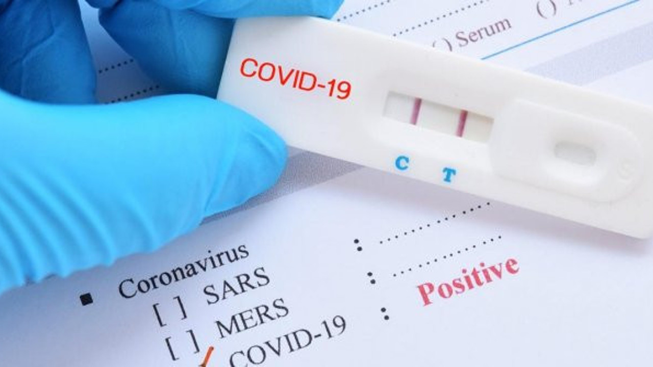 Korona ile grip testi birleşiyor. Bu sayede vaka analizleri kolaylaşacak