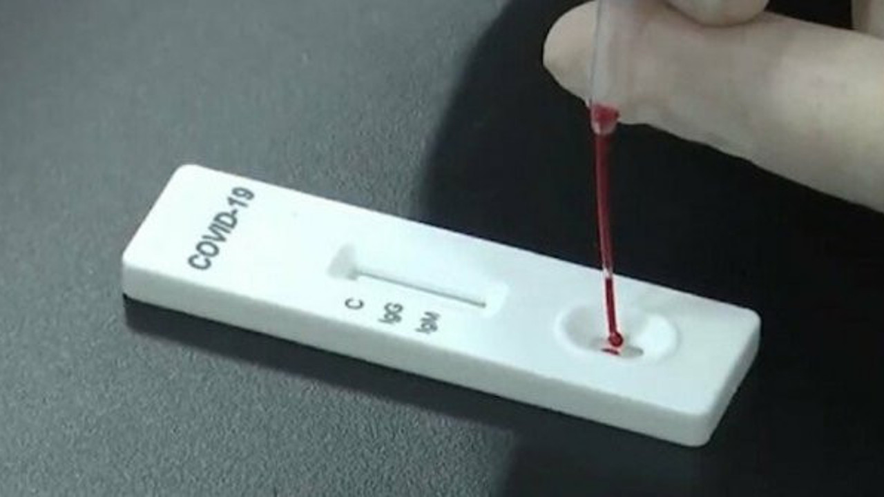 Bilim insanlarından dev buluş. Artık korona hastalığının şiddetini öğrenebileceksiniz