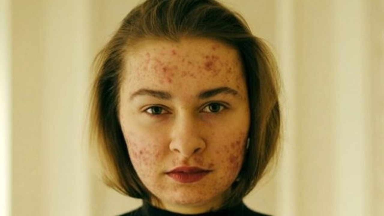 Bol bol şeker ve çikolata tüketince suratı tanınmaz hale geldi. Yerken çok dikkat edin. Sizin de başınıza gelebilir